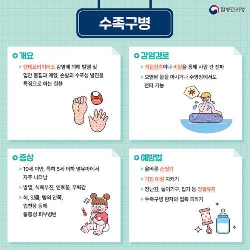 군산시보건소, 여름철 수족구병 예방수칙 준수 당부
